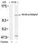 Nuclear Factor Kappa B Subunit 2 antibody, 79-405, ProSci, Western Blot image 