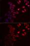 Purinergic Receptor P2X 4 antibody, GTX64406, GeneTex, Immunofluorescence image 