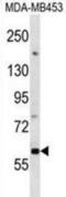 Death Associated Protein Kinase 1 antibody, abx028764, Abbexa, Western Blot image 