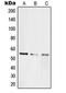 TERF2 Interacting Protein antibody, LS-C353469, Lifespan Biosciences, Western Blot image 