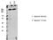 Large Tumor Suppressor Kinase 1 antibody, A01051T1079-1, Boster Biological Technology, Western Blot image 