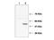 Ubiquitin Conjugating Enzyme E2 J1 antibody, NBP1-78065, Novus Biologicals, Western Blot image 