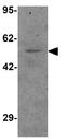 Pannexin 1 antibody, GTX31510, GeneTex, Western Blot image 