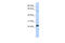 Zinc Finger Protein 460 antibody, 26-545, ProSci, Western Blot image 