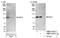 EMAP Like 4 antibody, NBP1-05974, Novus Biologicals, Western Blot image 