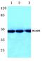 Branched Chain Keto Acid Dehydrogenase Kinase antibody, A07798-1, Boster Biological Technology, Western Blot image 