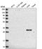 Retinol Dehydrogenase 16 antibody, HPA038518, Atlas Antibodies, Western Blot image 