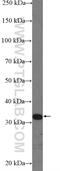 RNA Binding Motif Protein 7 antibody, 21896-1-AP, Proteintech Group, Western Blot image 