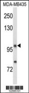 Neuropilin 1 antibody, MBS9213945, MyBioSource, Western Blot image 