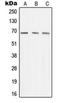 Menin 1 antibody, orb214242, Biorbyt, Western Blot image 