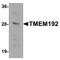 Transmembrane Protein 192 antibody, A11938, Boster Biological Technology, Western Blot image 