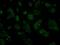 Intraflagellar Transport 57 antibody, MA5-25043, Invitrogen Antibodies, Immunocytochemistry image 