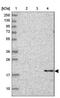 Cerebellin 3 Precursor antibody, NBP1-85844, Novus Biologicals, Western Blot image 