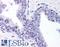 DNA Methyltransferase 3 Alpha antibody, LS-B280, Lifespan Biosciences, Immunohistochemistry paraffin image 