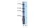 Zinc Finger Protein 691 antibody, 27-498, ProSci, Western Blot image 