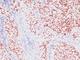 NK2 Homeobox 1 antibody, NBP2-44499, Novus Biologicals, Immunohistochemistry frozen image 