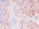 NK2 Homeobox 1 antibody, NBP2-44499, Novus Biologicals, Immunohistochemistry frozen image 