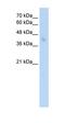 SAM Pointed Domain Containing ETS Transcription Factor antibody, orb329623, Biorbyt, Western Blot image 