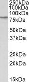 Interferon Gamma Receptor 1 antibody, 43-295, ProSci, Enzyme Linked Immunosorbent Assay image 