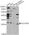 Major Histocompatibility Complex, Class II, DP Beta 1 antibody, LS-C748367, Lifespan Biosciences, Western Blot image 