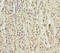 Ring Finger And FYVE Like Domain Containing E3 Ubiquitin Protein Ligase antibody, LS-C676386, Lifespan Biosciences, Immunohistochemistry paraffin image 