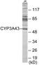 Cytochrome P450 Family 3 Subfamily A Member 43 antibody, EKC1918, Boster Biological Technology, Western Blot image 