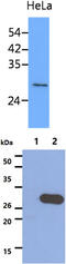 Stomatin antibody, MBS200319, MyBioSource, Western Blot image 