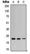 RAB5C, Member RAS Oncogene Family antibody, LS-C368621, Lifespan Biosciences, Western Blot image 