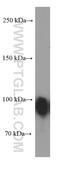 Gelsolin antibody, 66280-1-Ig, Proteintech Group, Western Blot image 