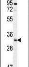 Nucleolar And Spindle Associated Protein 1 antibody, PA5-24479, Invitrogen Antibodies, Western Blot image 