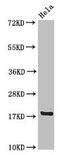 Ribosomal Protein S15 antibody, CSB-PA020372LA01HU, Cusabio, Western Blot image 