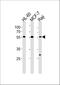 Chromosome 16 Open Reading Frame 71 antibody, A18346, Boster Biological Technology, Western Blot image 