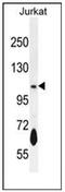 Phosphodiesterase 3B antibody, AP53235PU-N, Origene, Western Blot image 