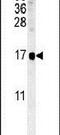 Suppressor Of IKBKE 1 antibody, PA5-25292, Invitrogen Antibodies, Western Blot image 