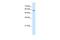 Chaperonin Containing TCP1 Subunit 8 antibody, PA5-69389, Invitrogen Antibodies, Western Blot image 