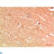 Autophagy Related 13 antibody, LS-C813179, Lifespan Biosciences, Immunohistochemistry paraffin image 