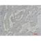AKT Serine/Threonine Kinase 2 antibody, LS-C387860, Lifespan Biosciences, Immunohistochemistry frozen image 
