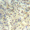 Cofilin 1 antibody, abx000378, Abbexa, Western Blot image 