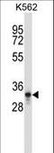 Pancreas Associated Transcription Factor 1a antibody, LS-C162270, Lifespan Biosciences, Western Blot image 