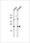 ORMDL Sphingolipid Biosynthesis Regulator 3 antibody, 55-381, ProSci, Western Blot image 