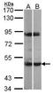 MAPK Activated Protein Kinase 5 antibody, TA308640, Origene, Western Blot image 