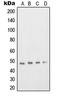 Transcription Factor Dp-2 antibody, LS-C352919, Lifespan Biosciences, Western Blot image 
