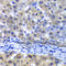 Proteasome 26S Subunit, Non-ATPase 8 antibody, A6955, ABclonal Technology, Immunohistochemistry paraffin image 