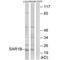 Secretion Associated Ras Related GTPase 1B antibody, A07030, Boster Biological Technology, Western Blot image 