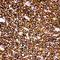 CD20 antibody, LS-C313533, Lifespan Biosciences, Immunohistochemistry paraffin image 