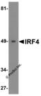 Interferon Regulatory Factor 4 antibody, 6307, ProSci, Western Blot image 