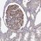 Natriuretic Peptide Receptor 3 antibody, NBP2-55875, Novus Biologicals, Immunohistochemistry paraffin image 