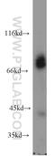 Microtubule Affinity Regulating Kinase 2 antibody, 15492-1-AP, Proteintech Group, Western Blot image 