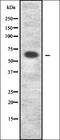 Inhibitor Of Bruton Tyrosine Kinase antibody, orb337677, Biorbyt, Western Blot image 