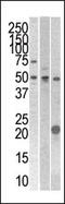 Serine/Threonine/Tyrosine Kinase 1 antibody, 63-173, ProSci, Western Blot image 